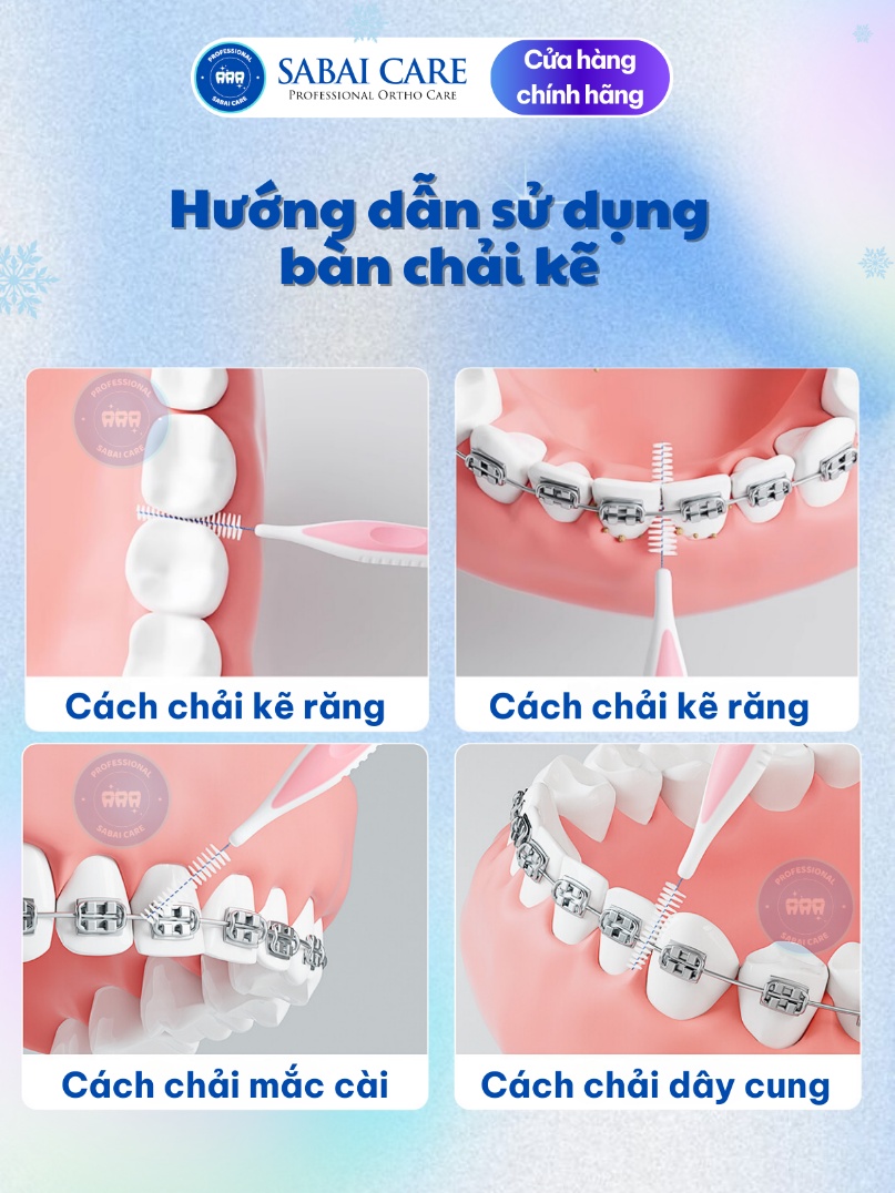 Hướng dẫn sử dụng bàn chải kẽ - Cách chải kẽ răng, mắc cài, dây cung